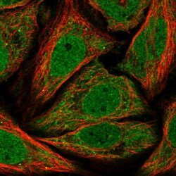 TIMM17A Antibody, Novus Biologicals 25 &mu;L; Unlabeled:Antibodies, Polyclonal